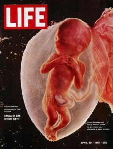 De foto’s van de Zweedse fotograaf Lennart Nilsson veroverden in 1965 de wereld. Hoewel voorgesteld als ‘het drama van het leven voor de geboorte’, toonden vele van zijn beelden chirurgisch verwijderde (dode) embryo’s en foetussen.
